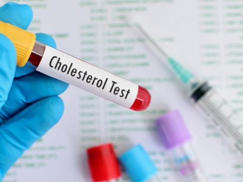 Kolesterol Belirtileri ve Kolesterolün Sebebi Nedir?